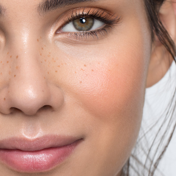 Seeing Spots: Dealing with Skin Discolorations