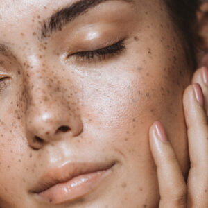 DOs and DON'Ts for Oily Skin