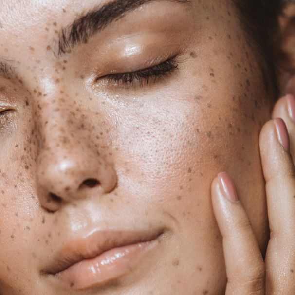 DOs and DON'Ts for Oily Skin